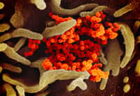 Le virus Sars-CoV-2 du Covid-19 vu au microscope électronique. Le virus apparaît en orange, en train de coloniser la surface des cellules (en vert). Les modèles tels que celui présenté par Visual Science permettent aux scientifiques de faire avancer leur compréhension du mode d’action du coronavirus. Pour le grand public, ils donnent du corps à cet ennemi par ailleurs invisible. © Niaid-RML